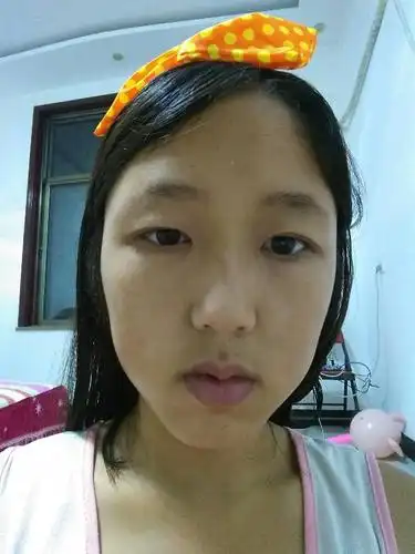 我一个大眼睛一个小眼睛很明显严重影响美观我该怎么办,我很烦恼