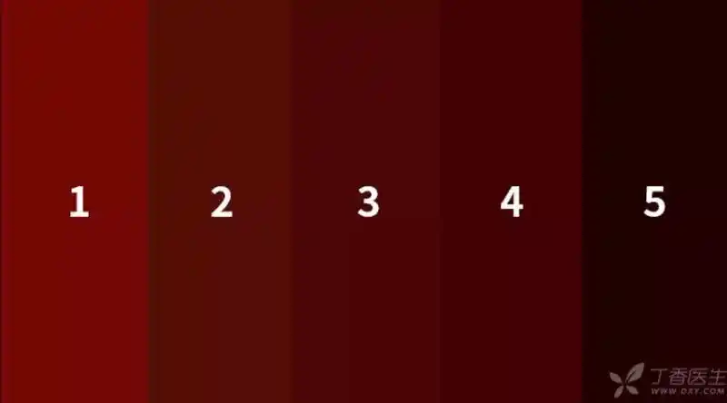 血是什么颜色的?