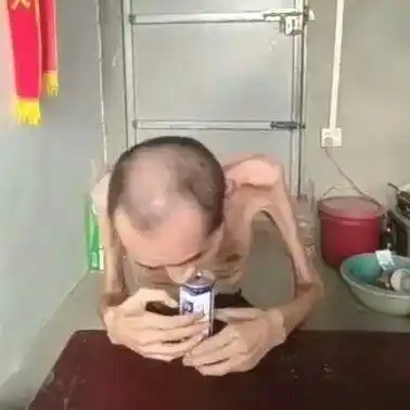 男子瘦成排骨,看起来像个"假人",揭开真相让人心寒