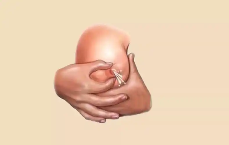 产后涨奶比生娃还痛!解除涨奶的小技巧有哪些?