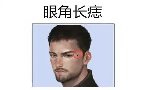 事业痣,身体此处长吉痣,升官发财快,横财运强,个个成龙成凤