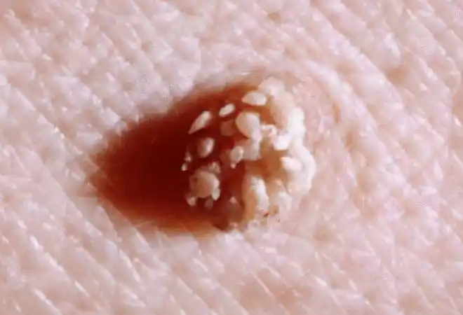 后悔不已,提醒:1物早有提示,少有人留意|子宫|分泌物_网易订阅