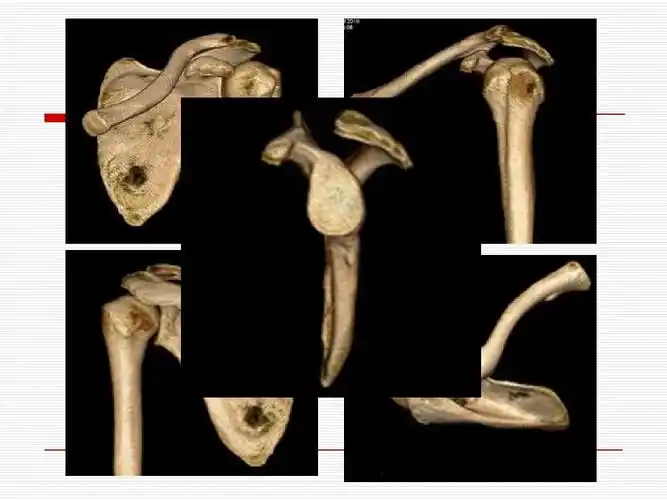 当前第3页) 你可能喜欢 mri诊断 肩关节mri 色素沉着绒毛结节性滑膜炎