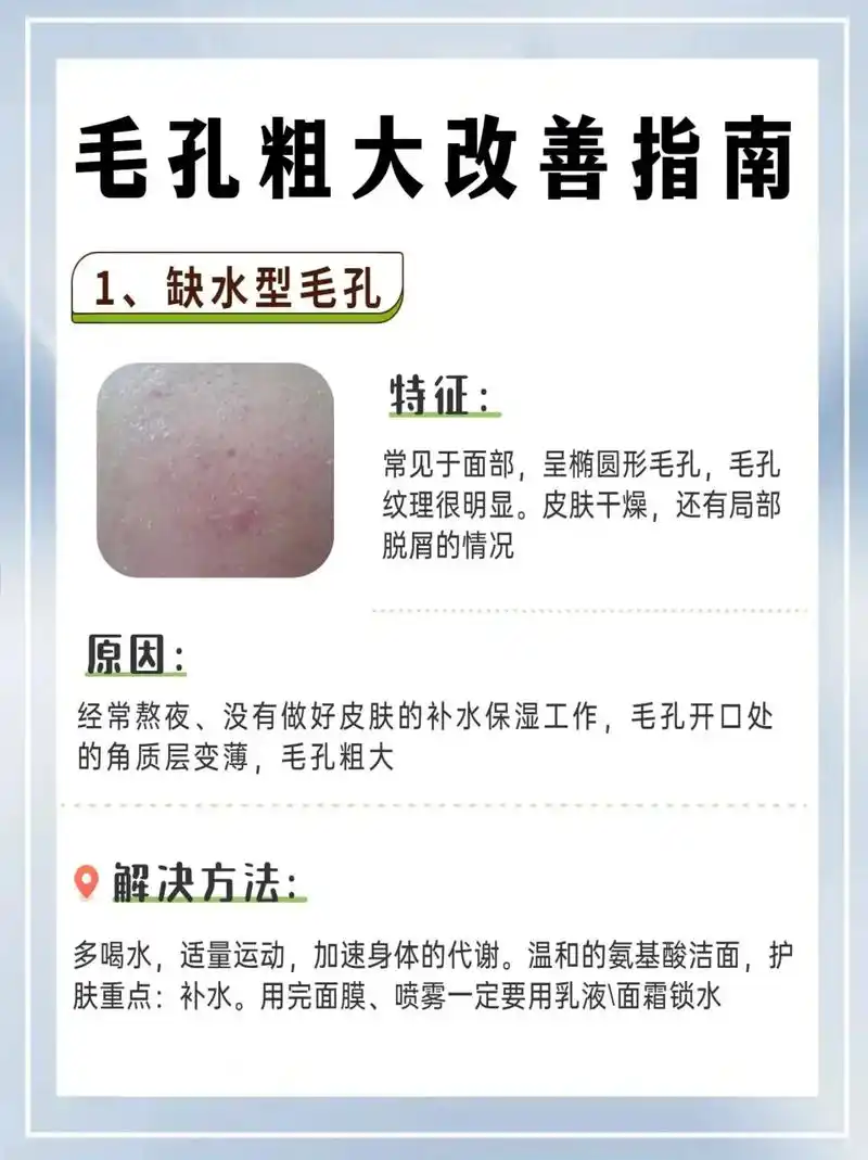 毛孔粗大是什么原因造成的 - 抖音