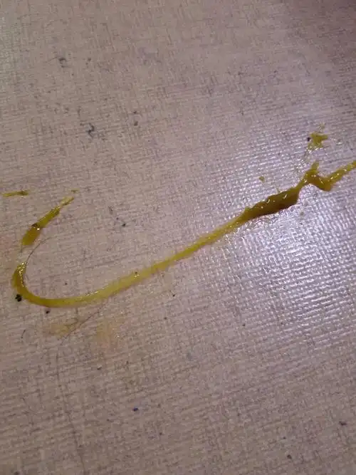 去拨动发现略有弹性 医院便检不出血 请问这有可能是寄生虫或蛔虫吗?