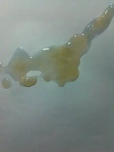 不正常精液液化图片8