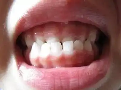 地包天为什么偏偏找上了你?看完这些你就懂了!