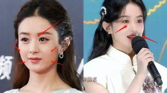 赵丽颖整容?11年前综艺旧照被找出,和现在对比,变化一目了然