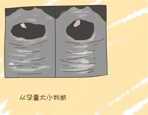 孕囊圆形和茄子形的区别