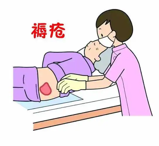 如何预防,处理褥疮?|水疱|溃疡|压疮|知名歌手_网易订阅