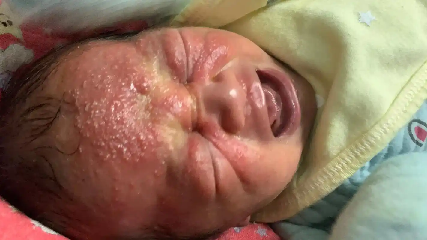 刚出生的婴儿不要嫌他丑 也不要丢 养着养着 越来越好看 越来 - 抖音