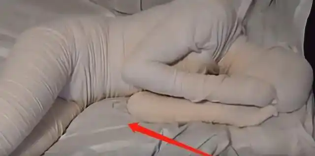 国外女子为保持身材,用绷带绑了自己3年,拆开后惊艳全场|木乃伊|减肥