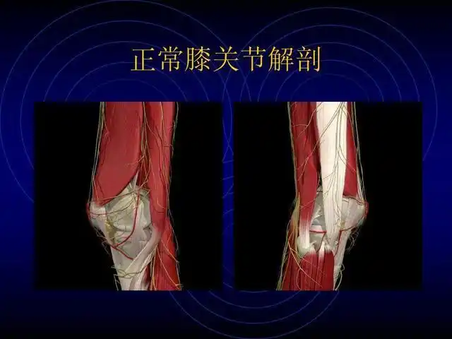 股骨髁骨折,主要并发症是什么?容易和哪些疾病混肴?预后如何?