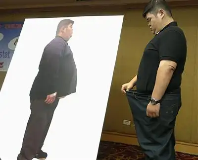 病态肥胖没开刀 男甩肉80公斤