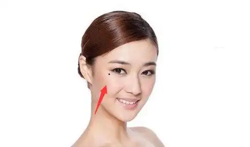 五颗破财痣家大业大都败光留着也是祸害