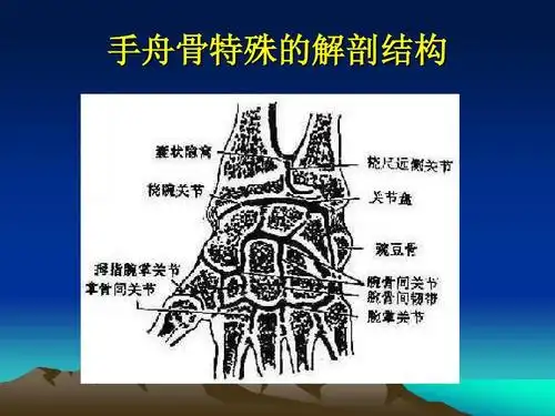 手舟骨骨折的治疗ppt