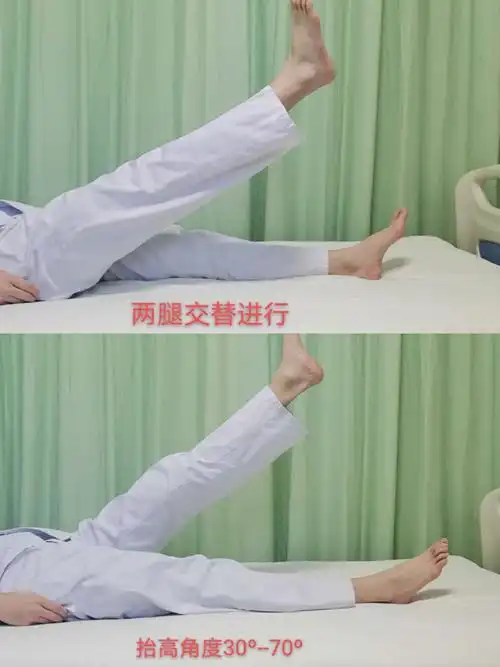 手术当天,指导患者行上肢运动及踝泵运动,每天4组,每组40次