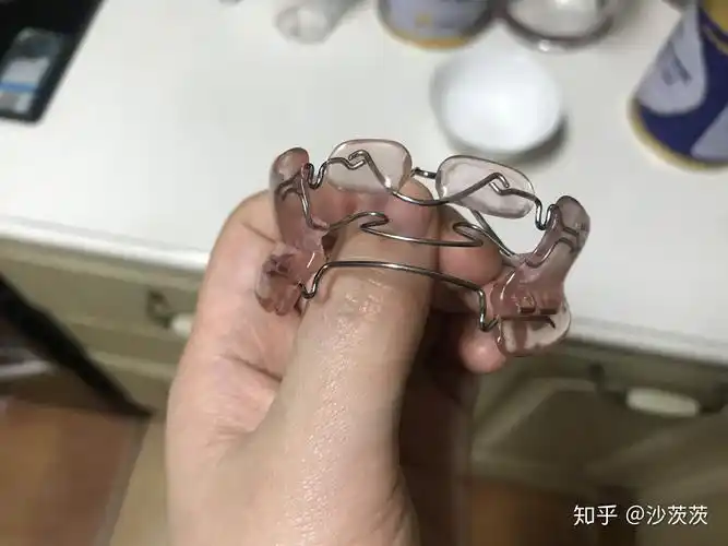 实时记录4岁儿童地包天矫正