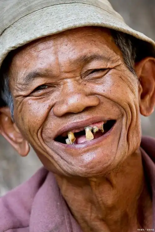 老人家掉牙实属正常?