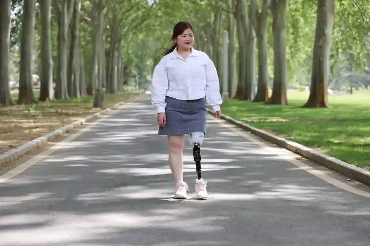 安装大腿假肢对残肢条件有哪些要求?_装配_长度_皮肤