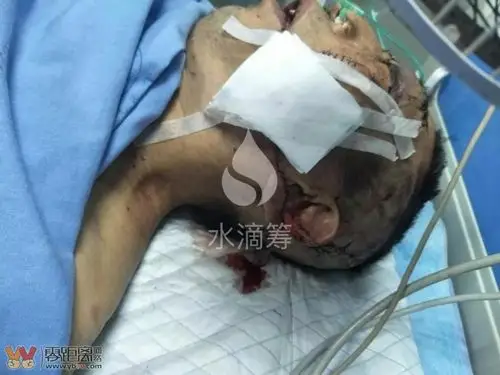 太吓人了!兴文一儿媳晚上提刀狂砍熟睡中的公婆!