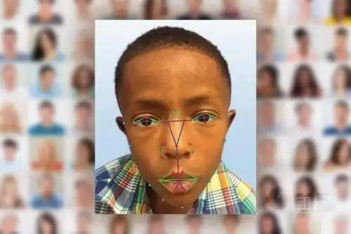 畸形数据集"项目,旨在记录世界各地多种不同遗传疾病患者的身体特质