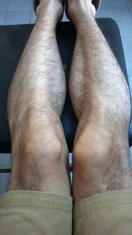 [android]我这腿毛正常吗