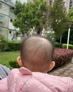 婴儿头型后脑勺标准2