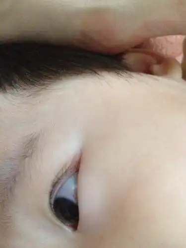 孩子眼睛红了 要不要紧?