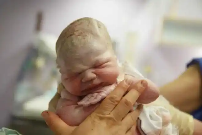 出生时若有3个特征,说明宝宝在娘胎发育得很好,你家娃中几条|新生儿