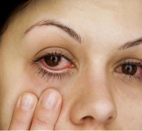 眼睛干涩有异物感不打紧小心干眼症损害视力