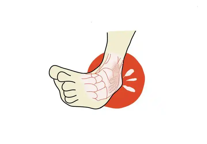 【护健图文】"崴脚"莫轻视,处理要及时