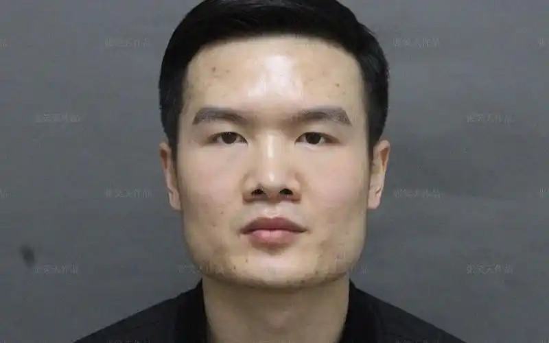 方脸系列|标准国字脸,下颌角外翻 咬肌肥厚,期待小哥术后变化_哔哩