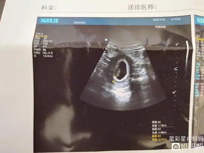 或可见胎芽如果是正常的宫内,怀孕40天左右可以通过b超在内看到孕囊