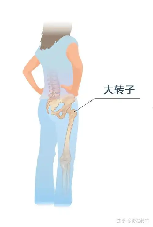 跟阔筋膜张肌相连,经过大腿骨的顶部,也就是"大转子"