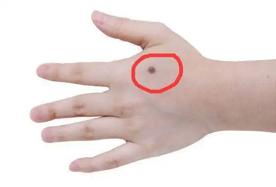 面相学:身上这几处有痣的女人,旺夫旺子,注定是有福之人!