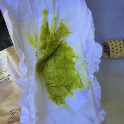 问答 婴儿期0-1岁 宝宝树孕育 90%的妈妈正在使用 宝宝树孕育 90%的