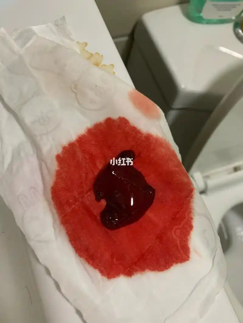 记录第三次出血00_怀孕_护垫_内裤_孕期日记_卫生巾_湿纸巾_公婆