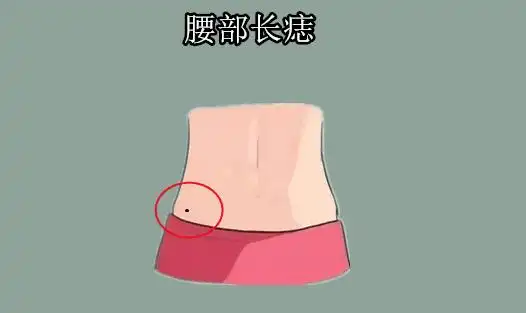 在相学当中,若是在背部正中央的位置处长有吉痣,则往往此人的依靠能力