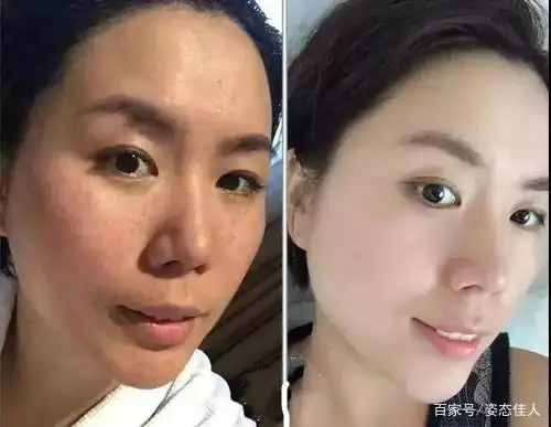 巧用苹果加它敷脸,半个月赶走色斑暗沉,皮肤变得白嫩又水润