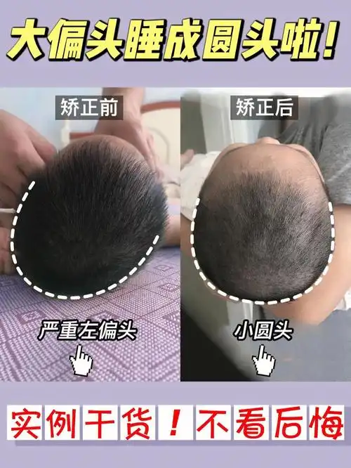 我经常和妈妈讨论头型的时候,说的最多的一句话:偏头是所有问题形状