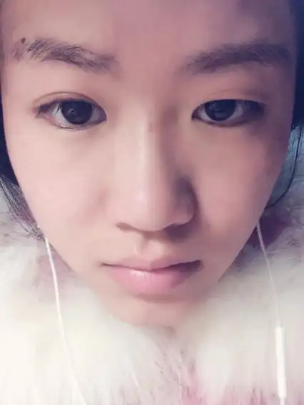 本人天生眼睛一单一双,左眼双,右眼单.