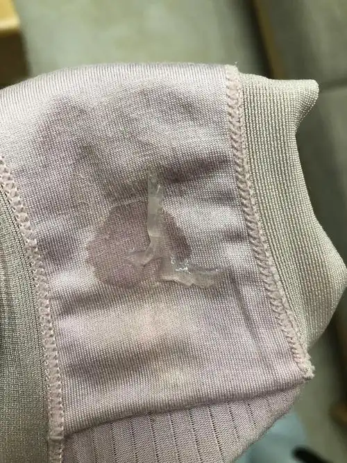 果冻样白带是怎么肥四离上个月经周期有一个月了