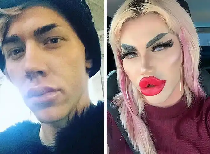 但是你很难想象,居然有男性也想整容成芭比娃娃