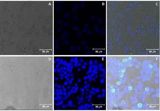 yellow fever virus envelope protein expressed in insect cells is