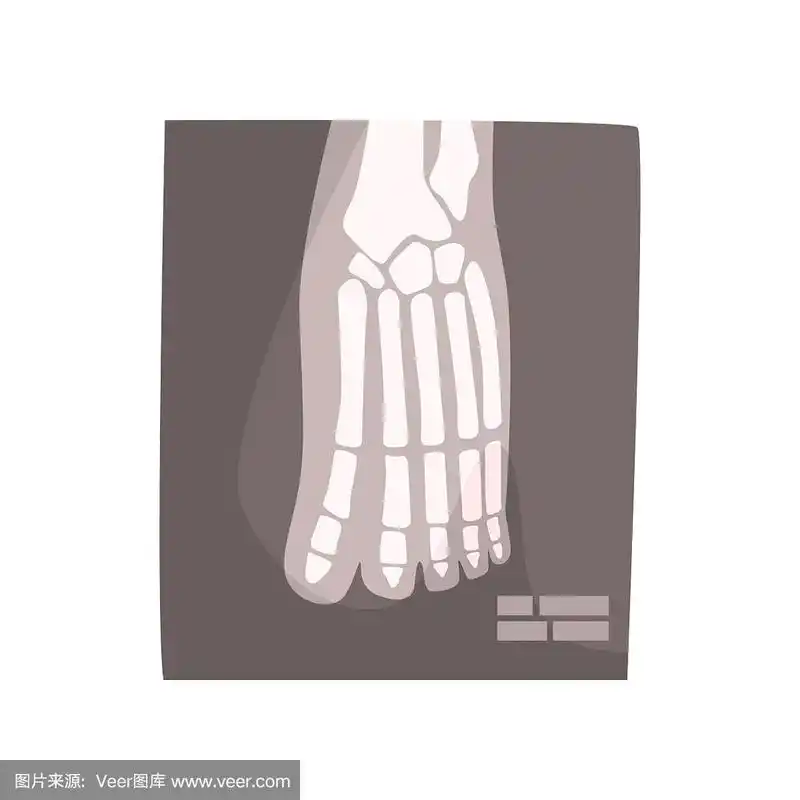 x射线图像的人的脚卡通