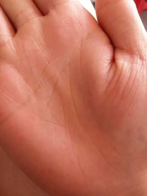 女的生命线左右手都有两条,代表什么?