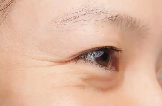 眼部的细纹为什么保养了却效果一般?