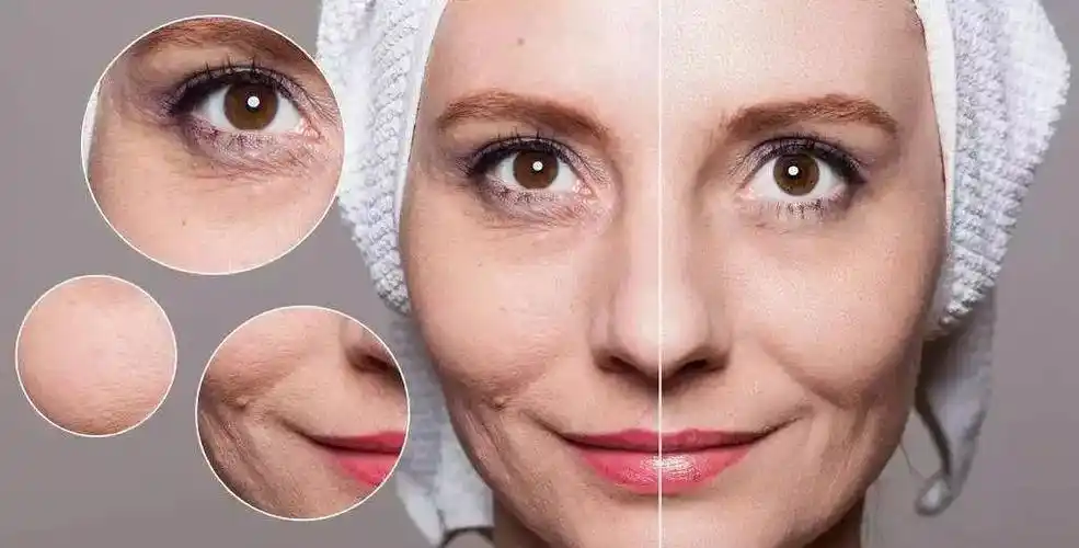 细纹篇:最实用4个技巧,祛掉细纹!让你年轻3-5岁,皮肤紧致光滑__凤凰网