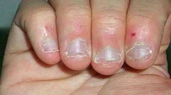 别在想着孩子"咬指甲"是缺乏维生素啦,他们是心脏功能发育差!